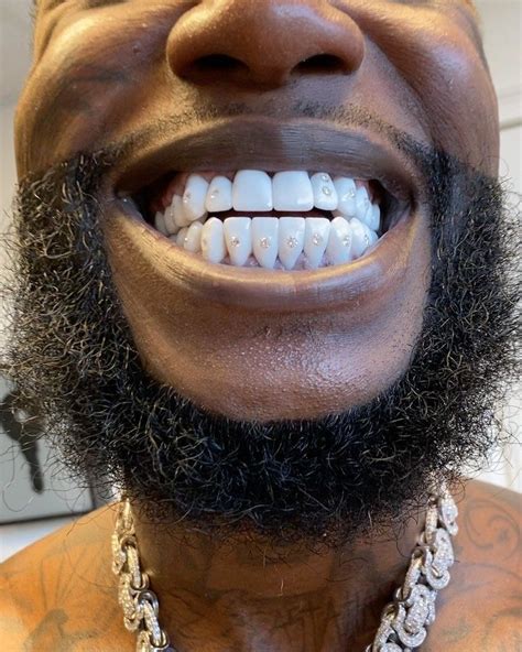 does gucci mane have fake teeth|7 Rappers Who Got Veneers .